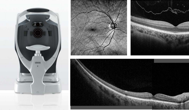 New, Improved Optometry Equipment