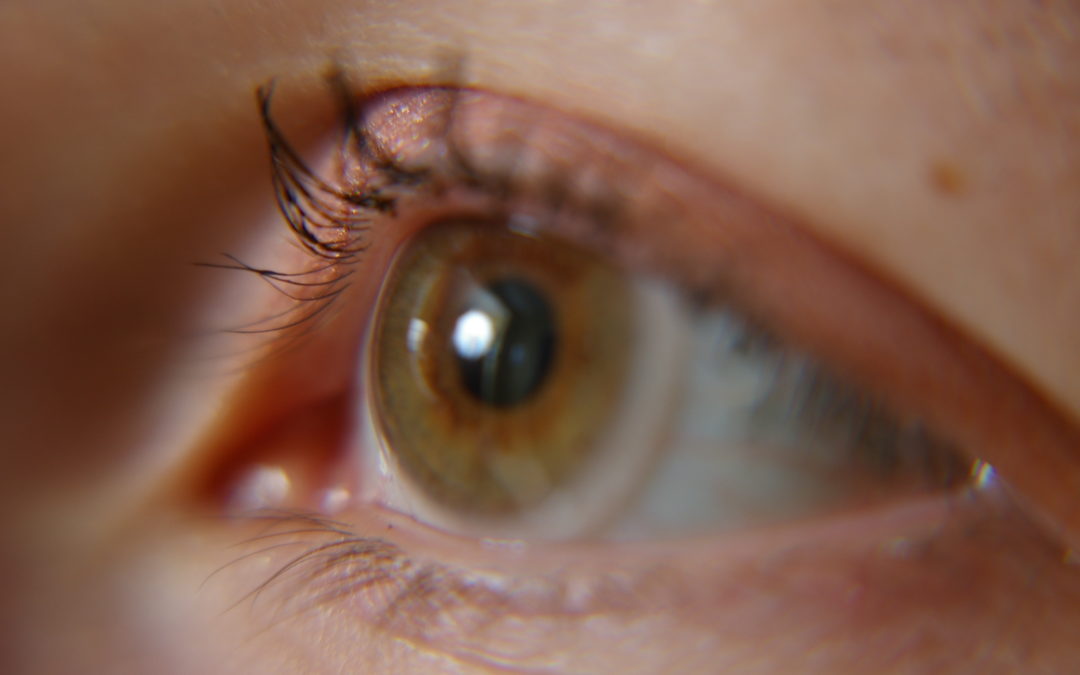 Key things you should know about contact lenses