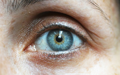 The Connection Between Diabetes and Vision Loss